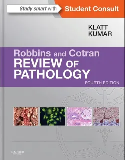 Robbins and Cotran Review of Pathology 4th Edition