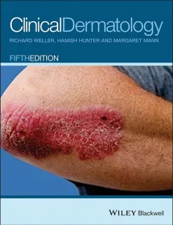 Clinical Dermatology Text Book